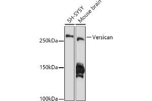 Western blot analysis of extracts of various cell lines, using Versican antibody (ABIN7271309) at 1:1000 dilution. (Versican 抗体)