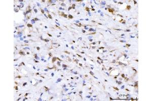 IHC analysis of FGF2 using anti-FGF2 antibody (ABIN7603215). (FGF2 抗体  (N-Term))