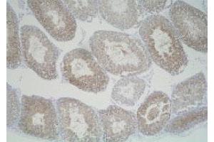 Immunohistochemistry (Formalin/PFA-fixed paraffin-embedded sections) of mouse testis with Slc25a19 polyclonal antibody . (SLC25A19 抗体)