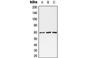 Western blot analysis of Monoamine Oxidase A expression in HEK293T (A), Raw264. (Monoamine Oxidase A 抗体  (Center))