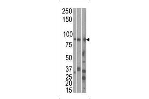 The anti-MARK1 C-term Pab is used in Western blot to detect MARK1 in, from left to right, Hela, T47D, and mouse brain cell line/ tissue lysate. (MARK1 抗体  (C-Term))