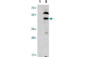 Western blot analysis of PDGFRL (arrow) using PDGFRL polyclonal antibody . (PDGFRL 抗体  (C-Term))