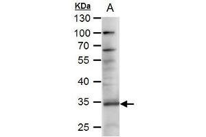 Western Blotting (WB) image for anti-Tumor Necrosis Factor (Ligand) Superfamily, Member 11 (TNFSF11) (C-Term) antibody (ABIN2856613)