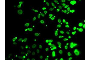 Immunofluorescence analysis of A549 cell using FIP1L1 antibody. (FIP1L1 抗体)