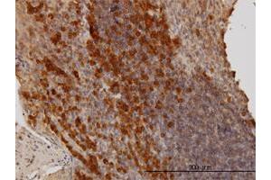 Immunohistochemistry (Formalin-fixed Paraffin-embedded Sections) (IHC (fp)) image for anti-BCL2-Associated Athanogene (BAG1) (AA 241-345) antibody (ABIN560027)