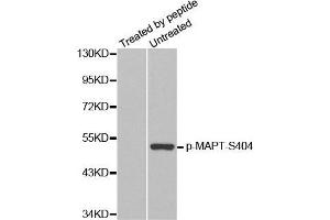 Western Blotting (WB) image for anti-Microtubule-Associated Protein tau (MAPT) (pSer404) antibody (ABIN3019704) (MAPT 抗体  (pSer404))
