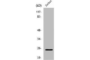 Western Blot analysis of Jurkat cells using Rit1 Polyclonal Antibody (RIT1 抗体  (C-Term))