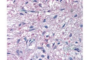 Anti-GPR50 antibody IHC of human pituitary. (GPR50 抗体  (C-Term))