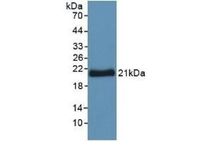 Detection of Recombinant YWHAz, Human using Polyclonal Antibody to Tyrosine 3/Tryptophan 5 Monooxygenase Activation Protein Zeta (YWHAz) (14-3-3 zeta 抗体  (AA 1-245))