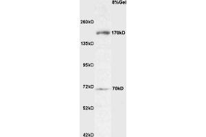 ROBO4 antibody  (AA 261-360)