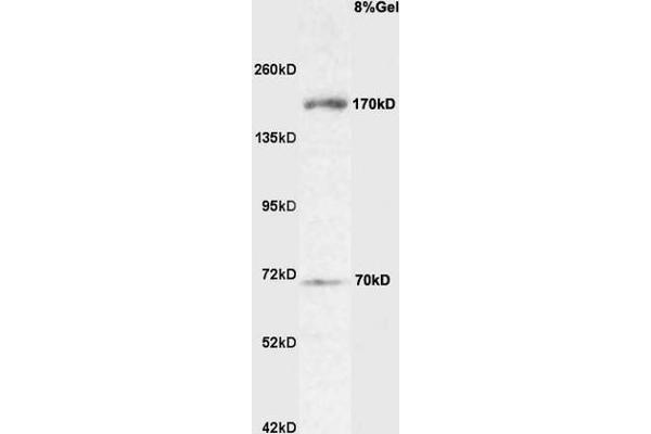 ROBO4 antibody  (AA 261-360)
