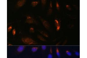 Immunofluorescence analysis of U-2 OS cells using IKK alpha Polyclonal Antibody at dilution of 1:100. (IKK alpha 抗体)