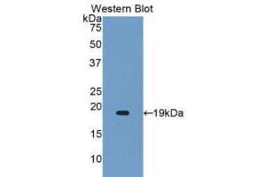 Western Blotting (WB) image for anti-Alpha2 Antiplasmin (SERPINF2) (AA 340-491) antibody (ABIN1172474) (alpha 2 Antiplasmin 抗体  (AA 340-491))