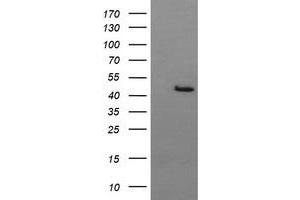 Image no. 2 for anti-butyrobetaine (Gamma), 2-Oxoglutarate Dioxygenase (Gamma-butyrobetaine Hydroxylase) 1 (BBOX1) antibody (ABIN1496820) (BBOX1 抗体)