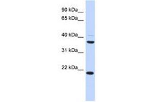TMEM74 抗体  (AA 215-264)