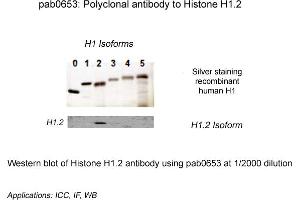 Image no. 1 for anti-Histone Cluster 1, H1c (HIST1H1C) (N-Term) antibody (ABIN410164) (HIST1H1C 抗体  (N-Term))