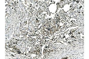 IHC analysis of GRHL2 using anti-GRHL2 antibody (ABIN7599505).