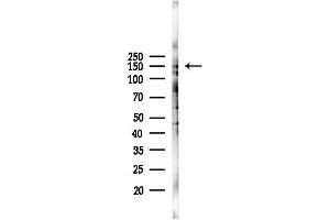 anti-Myelodysplasia Syndrome 1 (MDS1) antibody