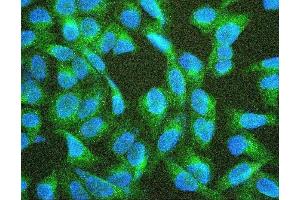 IF analysis of TEK using anti-TEK antibody (ABIN7600762). (TEK 抗体  (AA 23-616))