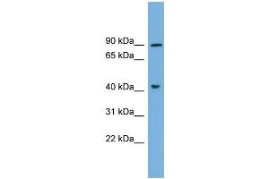 WB Suggested Anti-DYRK1A Antibody Titration: 0.