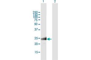 Western Blot analysis of MS4A12 expression in transfected 293T cell line by MS4A12 MaxPab polyclonal antibody. (MS4A12 抗体  (AA 1-267))