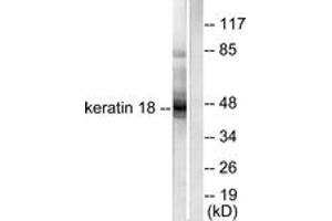 Western blot analysis of extracts from HeLa cells, using Keratin 18 Antibody. (Cytokeratin 18 抗体  (AA 381-430))