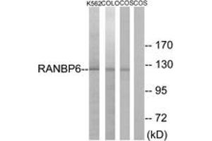Western blot analysis of extracts from COS7/K562/COLO cells, using RANBP6 Antibody. (RANBP6 抗体  (AA 800-849))