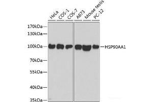 Western blot analysis of extracts of various cell lines using HSP90AA1 Polyclonal Antibody at dilution of 1:500. (HSP90AA1 抗体)