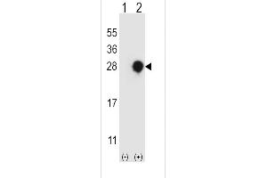 Western blot analysis of RGS4 using rabbit polyclonal RGS4 Antibody using 293 cell lysates (2 ug/lane) either nontransfected (Lane 1) or transiently transfected (Lane 2) with the RGS4 gene. (RGS4 抗体  (AA 147-174))