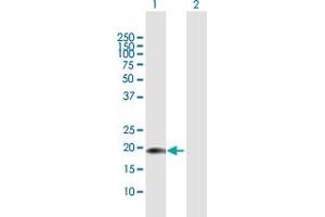 Western Blot analysis of CENPM expression in transfected 293T cell line by CENPM MaxPab polyclonal antibody. (CENPM 抗体  (AA 1-180))