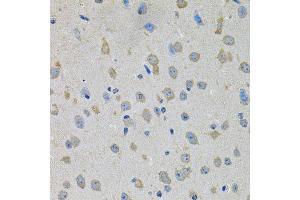 Immunohistochemistry of paraffin-embedded mouse brain using PTK7 antibody (ABIN6003571) at dilution of 1/100 (40x lens). (PTK7 抗体)