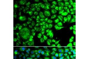 Immunofluorescence analysis of A549 cells using TBPL1 Polyclonal Antibody (TBPL1 抗体)