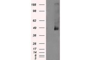 Western Blotting (WB) image for anti-Lysyl Oxidase (LOX) (AA 22-168) antibody (ABIN1491219) (LOX 抗体  (AA 22-168))