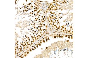 Immunohistochemistry of paraffin-embedded rat testis using  Rabbit pAb (ABIN6133085, ABIN6136806, ABIN6136807 and ABIN6215376) at dilution of 1:150 (40x lens). (ALKBH5 抗体  (AA 245-394))