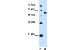 WB Suggested Anti-LMAN1 Antibody Titration:  1. (LMAN1 抗体  (Middle Region))