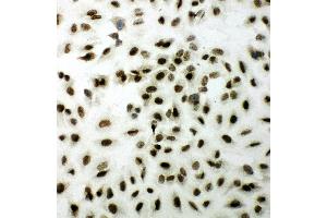 Immunohistochemistry (IHC) image for anti-X-Ray Repair Complementing Defective Repair in Chinese Hamster Cells 1 (XRCC1) (AA 15-34), (N-Term) antibody (ABIN3044234)