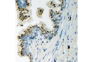 Immunohistochemical analysis of LLGL2 staining in human prostate formalin fixed paraffin embedded tissue section. (LLGL2 抗体)