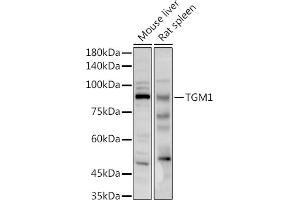 Western blot analysis of extracts of various cell lines, using TGM1 antibody (ABIN6129517, ABIN6149090, ABIN6149092 and ABIN6217322) at 1:1000 dilution. (TGM1 抗体  (AA 100-280))