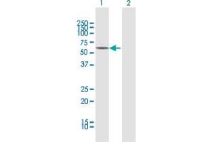 Western Blotting (WB) image for anti-Monoamine Oxidase B (MAOB) (AA 1-520) antibody (ABIN950013)