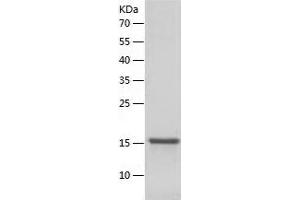 Western Blotting (WB) image for Methylmalonyl CoA Epimerase (MCEE) (AA 37-176) protein (His tag) (ABIN7123942) (MCEE Protein (AA 37-176) (His tag))