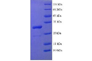 Homeobox B4 (HOXB4) (AA 1-251), (full length) protein (His tag)