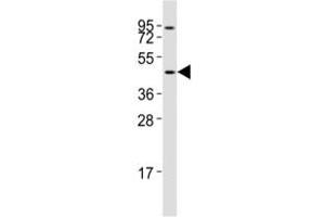 Western blot testing of CCR1 antibody at 1:2000 dilution + Jurkat lysate (CCR1 抗体  (AA 343-355))