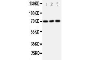 Western Blotting (WB) image for anti-Solute Carrier Family 6 (Neurotransmitter Transporter, serotonin), Member 4 (SLC6A4) (AA 7-24), (N-Term) antibody (ABIN3043084) (SLC6A4 抗体  (N-Term))