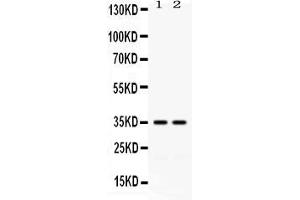 Western blot analysis of LFA3 expression in HELA whole cell lysates ( Lane 1) and K562 whole cell lysates ( Lane 2). (CD58 抗体  (AA 29-215))