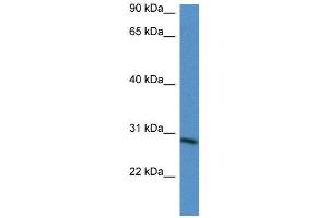 WB Suggested Anti-BARX2  Antibody Titration: 0. (BARX Homeobox 2 抗体  (N-Term))