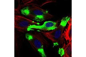 Immunofluorescence analysis of Hela cells using CD22 mouse mAb (green). (CD22 抗体  (AA 621-725))