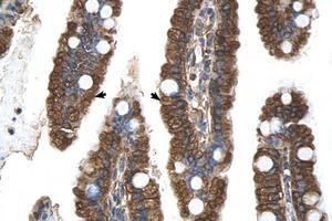 Image no. 1 for anti-Progesterone Receptor Membrane Component 1 (PGRMC1) (N-Term) antibody (ABIN6738268) (PGRMC1 抗体  (N-Term))