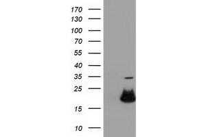 Western Blotting (WB) image for anti-Retinoblastoma Binding Protein 9 (RBBP9) antibody (ABIN1500628) (RBBP9 抗体)