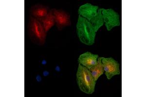 ABIN6264124 and ABIN6277517 staining  cells by IF/ICC. (PDZK1 抗体  (C-Term))