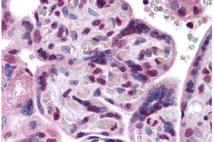 Human Placenta: Formalin-Fixed, Paraffin-Embedded (FFPE) (EPAS1 抗体  (AA 74-376))
